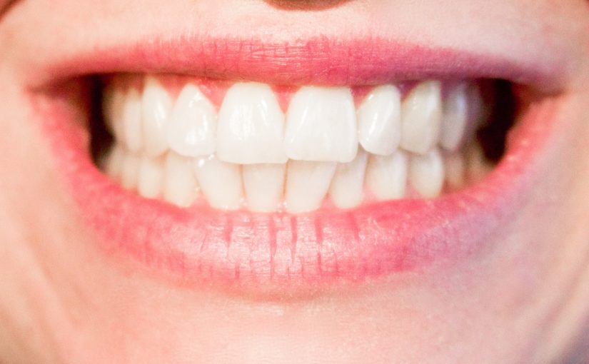 Dzisiejsza technika używana w salonach stomatologii estetycznej być może sprawić, że odbierzemy śliczny uśmiech.